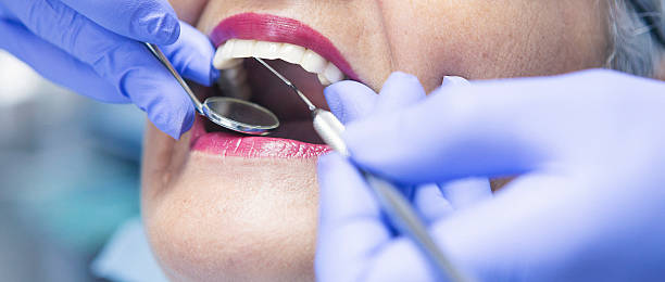 Best Chipped Tooth Repair Near Me  in Spanish Springs, NV